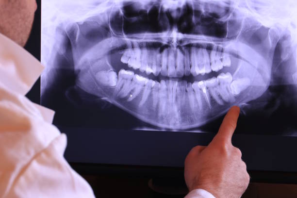 Best Emergency Dental Care for Abscessed Tooth in Athena, OR