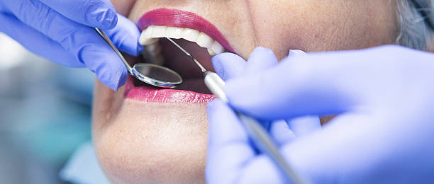 Best Emergency Dentist for Lost Fillings or Crowns in Athena, OR